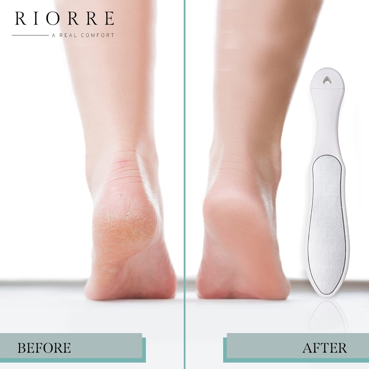 Professional Foot Scrubber for Hard Skin - Pack 1 (3 in 1) Pedicure Foot File, Foot Scraper & Callus Remover for Feet Leaving Soft & Smooth Heels